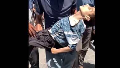 آخر ضحايا المجاعة والجوع في غزة