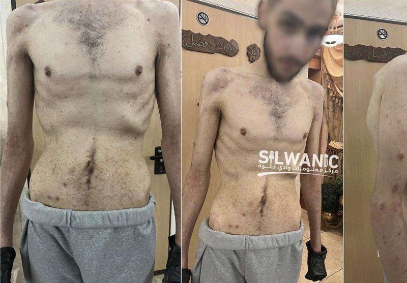 السجون الإسرائيلية ؛ مقبرة حية/ تعذيب وحشي كرسي