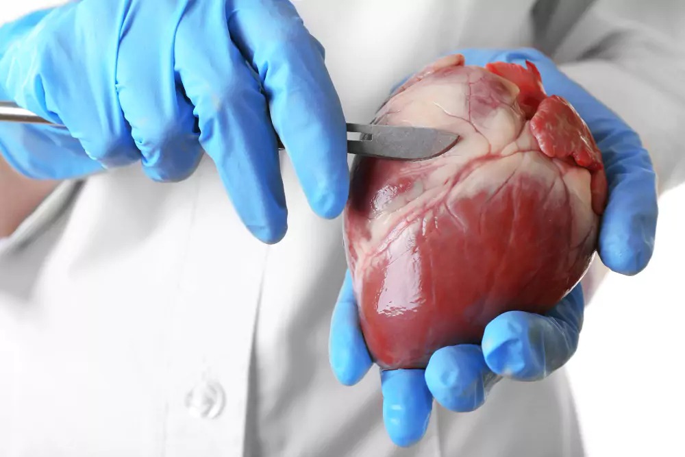 عملية القلب المفتوح في إيران