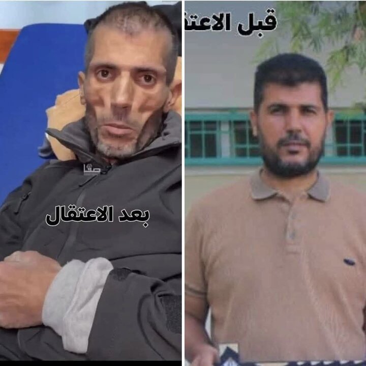 تغییر چهره شوکهکننده اسیر فلسطینی بعد از یک سال اسارت