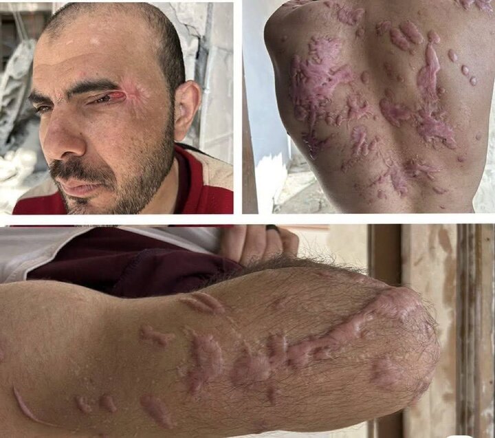 Works of Zionist brutal torture on the body of the released Palestinian+ Movie