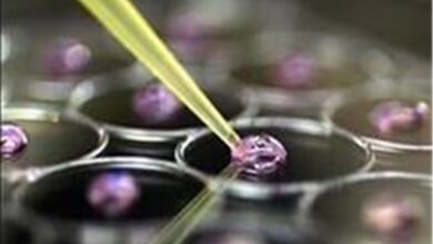 خبری خوش برای دیابتیها/ درمان زخمهای دیابتی و مزمن با سلولهای بنیادی