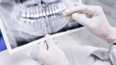 یک میلیون بیمار ایرانی، نیازمند ایمپلنتهای دندانی هستند