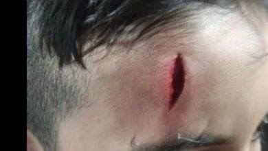 تنبیه بدنی یک دانشآموز در لرستان/ ابلاغ معلم لغو شد