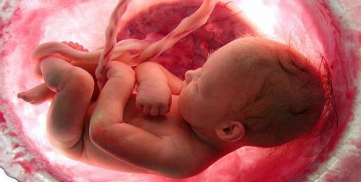 سقط جنین شایعترین پیامد کمبود ید در زنان باردار است