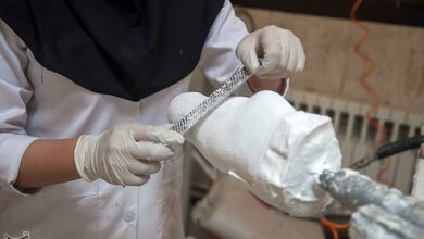 تولید ارتز، پروتز و اندامهای مصنوعی برای نخستینبار در ایران