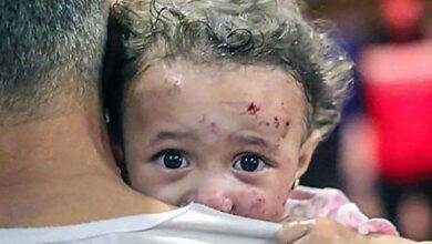 «جنگ گرسنگی» اشغالگران علیه غزه/ شیوع سوء تغذیه و ابتلای ۹۰ درصد کودکان به کمخونی