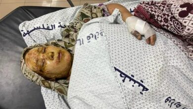 مرگ تدریجی بیماران در غزه/ هشدار درباره شیوع اپیدمیهای خطرناک با ورود به فصل سرما