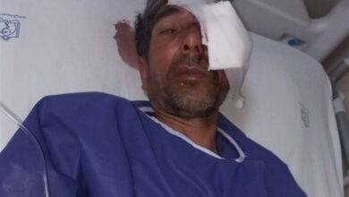 مصدومیت محیطبان تربت حیدریه پس از مواجهه با گراز