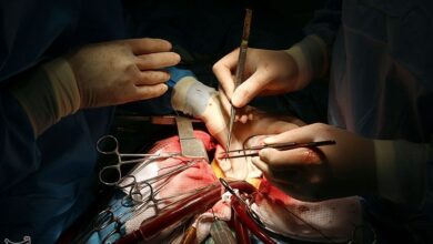 معرفی روش جدید جراحی قلب در علومپزشکی شیراز به عنوان برترین ابداع نوآورانه در دنیا