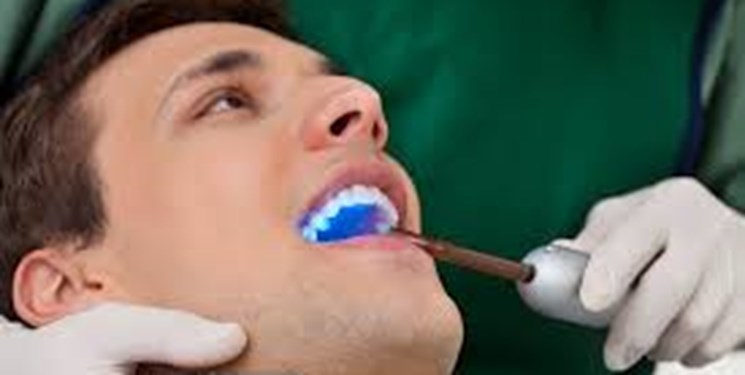 آیا مواد باندینگ دندان سرطانزا است؟