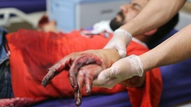 ثبت نخستین حادثه چهارشنبهسوری زاهدان با 2 مصدوم