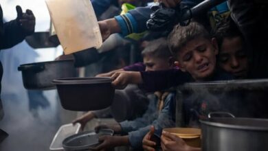 شهادت دردناک کودک فلسطینی در غزه بهدلیل سوء تغذیه شدید+ عکس