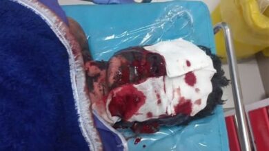 مصدومیت 95 نفر در چهارشنبهسوری کردستان؛ حال 5 نفر وخیم است