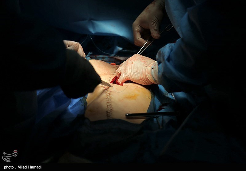 ثبت سومین اهدای عضو بیمار مرگ مغزی در کاشان