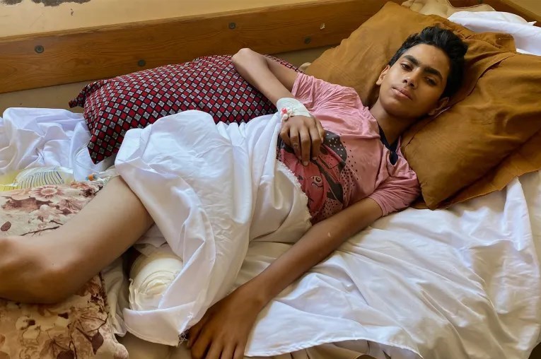 معلولیت کودکان غزه با سلاحهای ممنوعه اشغالگران اسرائیلی