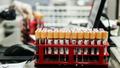 کردستانیها دهه نخست محرم 1100 واحد خون اهدا کردند