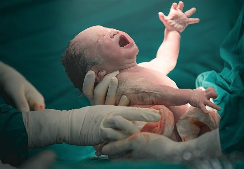 افزایش نرخ سزارین در کردستان/9425 مورد زایمان ثبت شد