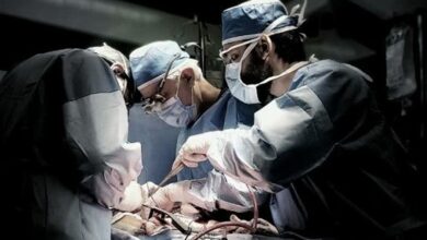 بیمار مرگ مغزی در کاشان جان 3 بیمار را نجات داد