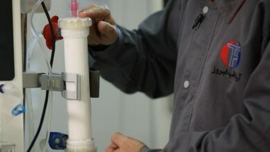 دیالیز روزانه 100 بیمار در بیمارستان بهشتی همدان