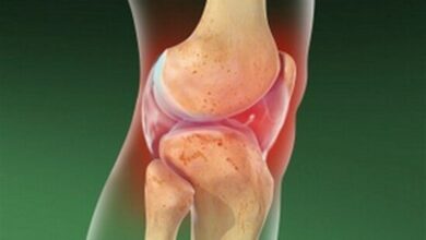 مازندران میزبان همایش ملی اختلالات اسکلتی ـ عضلانی شد