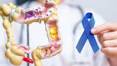 پیوند مغز استخوان رایگان برای 35 جوان سرطانی توسط یک خیریه