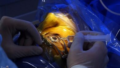 سپاه 120 کردستانی نیازمند را از نابینایی نجات داد+فیلم