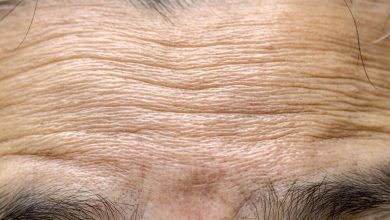 فیلرهای ایرانی با فناوری نانو و زیستفناوری، راهی نوین برای جوانسازی پوست / فیلر پوستی , جوانسازی پوست , فناوری نانو , زیستفناوری , شرکت دانشبنیان