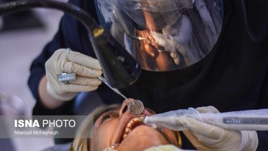 تولید پرینتر سهبعدی رزینی با دقت بالا برای کاربردهای دندانپزشکی / پرینتر سهبعدی , رزین , دندانپزشکی , دانش بنیان , نمونهسازی