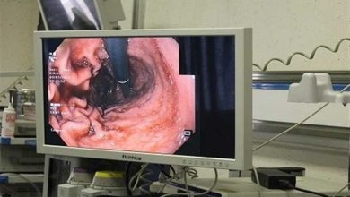 بیماریهای گوارشی در کودکان / اخبار فارس - اخبار استانها