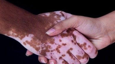 آغاز درمان یک بیماری مادرزادی با سلولهای بنیادی در شیراز / اخبار فارس - اخبار استانها