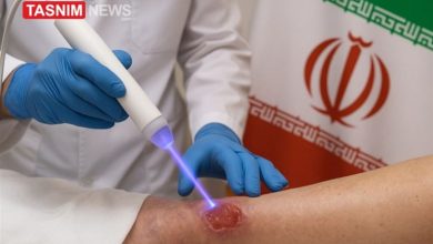 آغاز توسعه پلاسمادرمانی در سمنان؛ کاهش سفر بیماران به خارج استان / اخبار سمنان - اخبار استانها