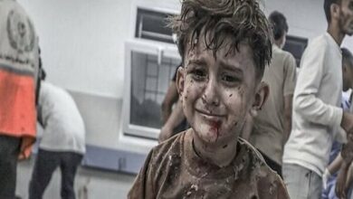 Gaza Health Ministry Reports 174,256 Casualties Amidst Ongoing Israeli Attacks /Gaza , Israel , Palestine , Health Ministry , Casualties