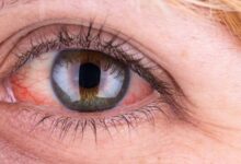 کابوس لوزالمعدههای مصنوعی در ایران